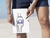 Why a knee replacement?