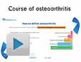 Course of osteoarthritis