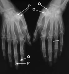 principios de la radiografía estándar osteoarticular