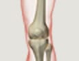 Osteoartritis de la rodilla