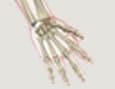 Osteoarthritis of the hands