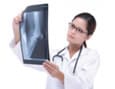 Radiographie de l'arthrose