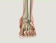 La Osteoartritis de los pies