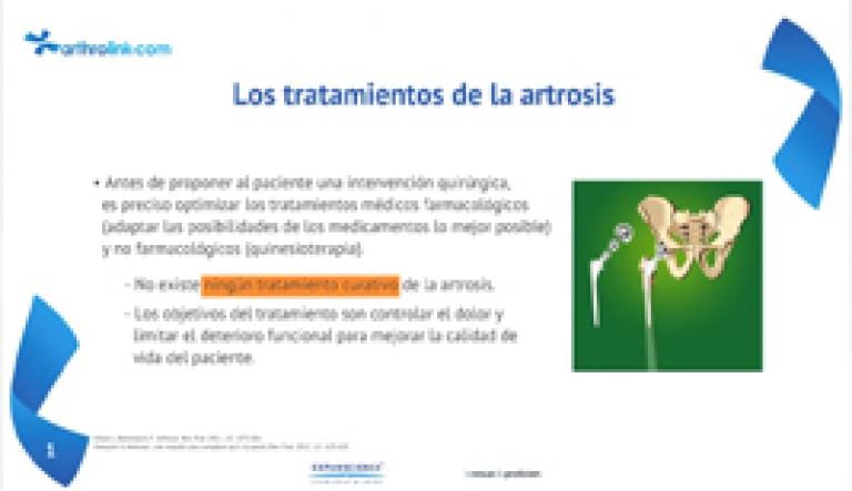 Gonartrosis  : consideracion del uso de una protesis