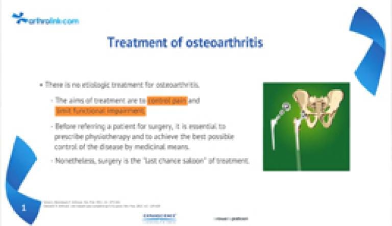 Osteoarthritis: when is a joint replacement necessary