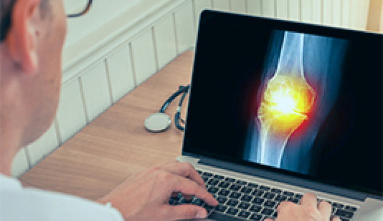Osteoarthritis diagnosis with standard X-rays